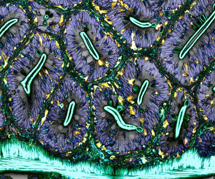 Photo Micrographics Nikon's Photomicrography Competition gives you a new view of the world