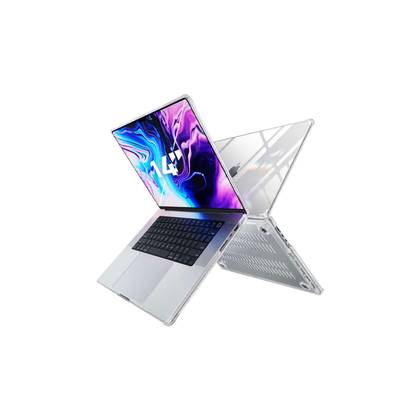 Hear me out with these 5 reasons to pick up a MacBook Pro case