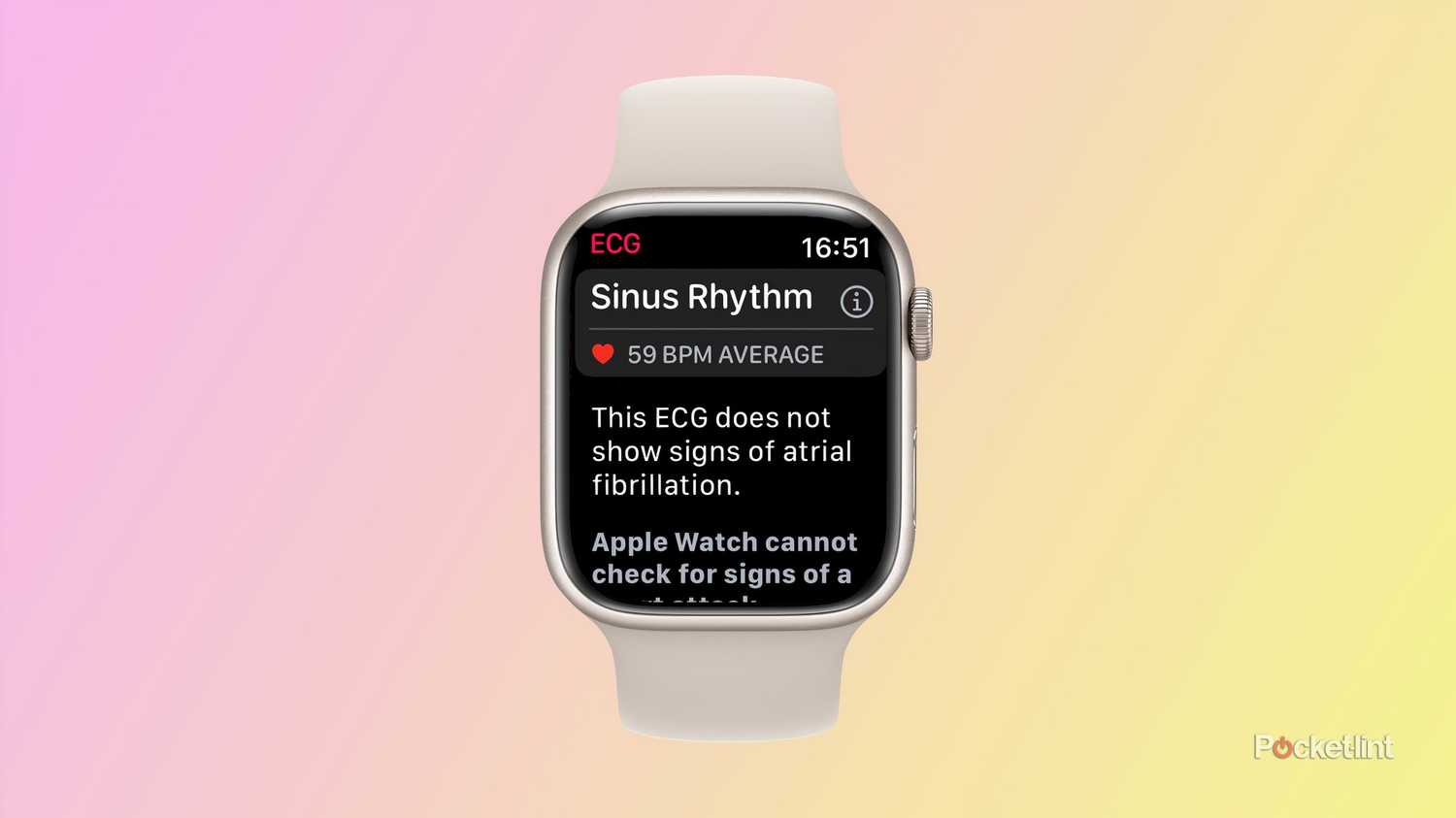 Look Like Apple Watch Ecg Examples Ekg On Apple Watch Series Deals
