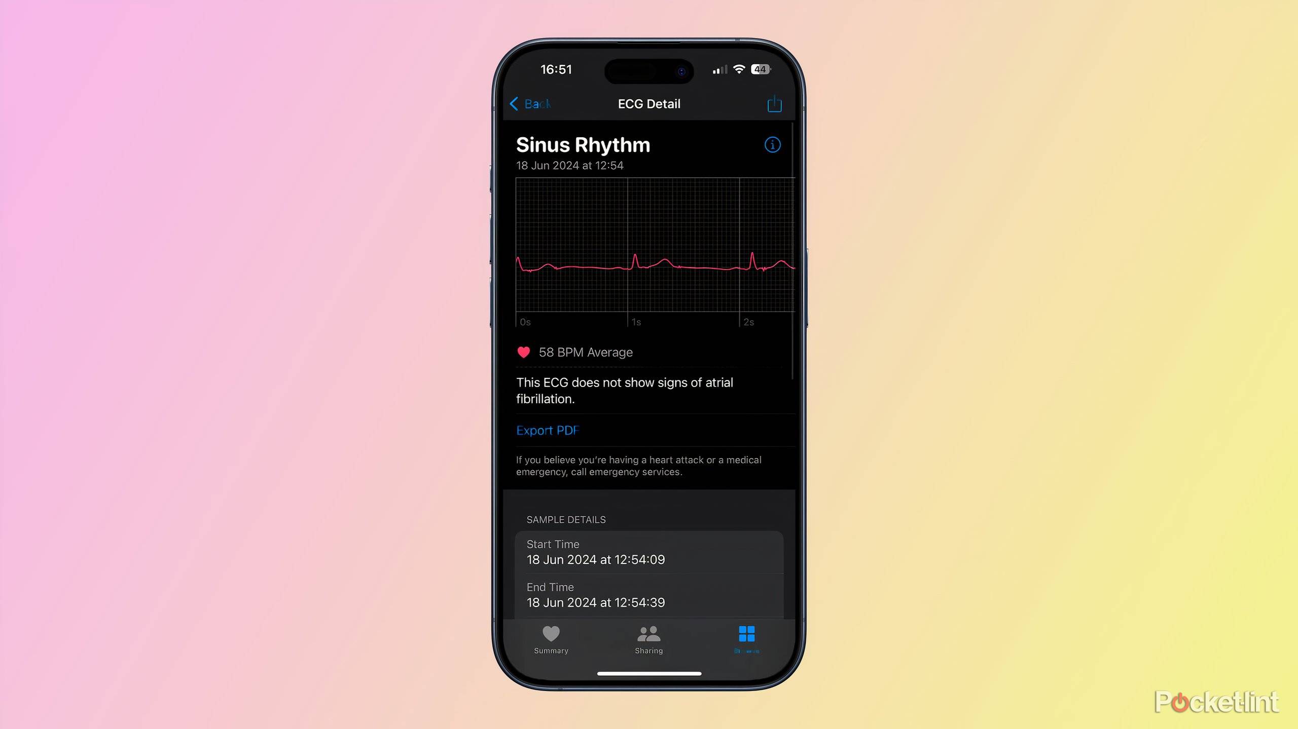 Ecg Does Apple Watch Measure Heart Rate Accurately How To Set