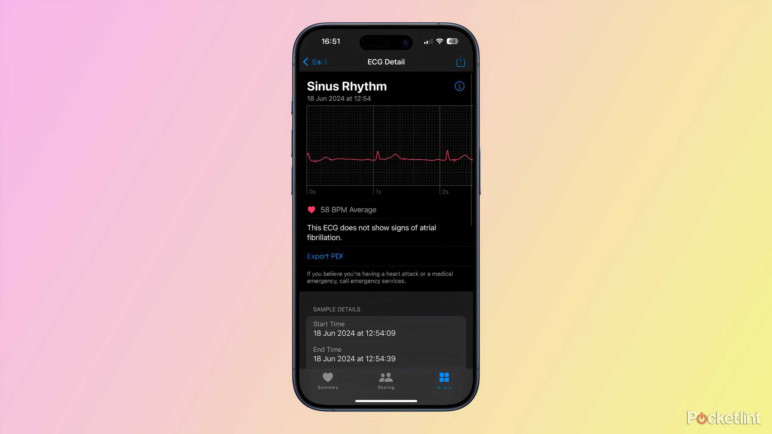 How to set up your Apple Watch's ECG heart health features
