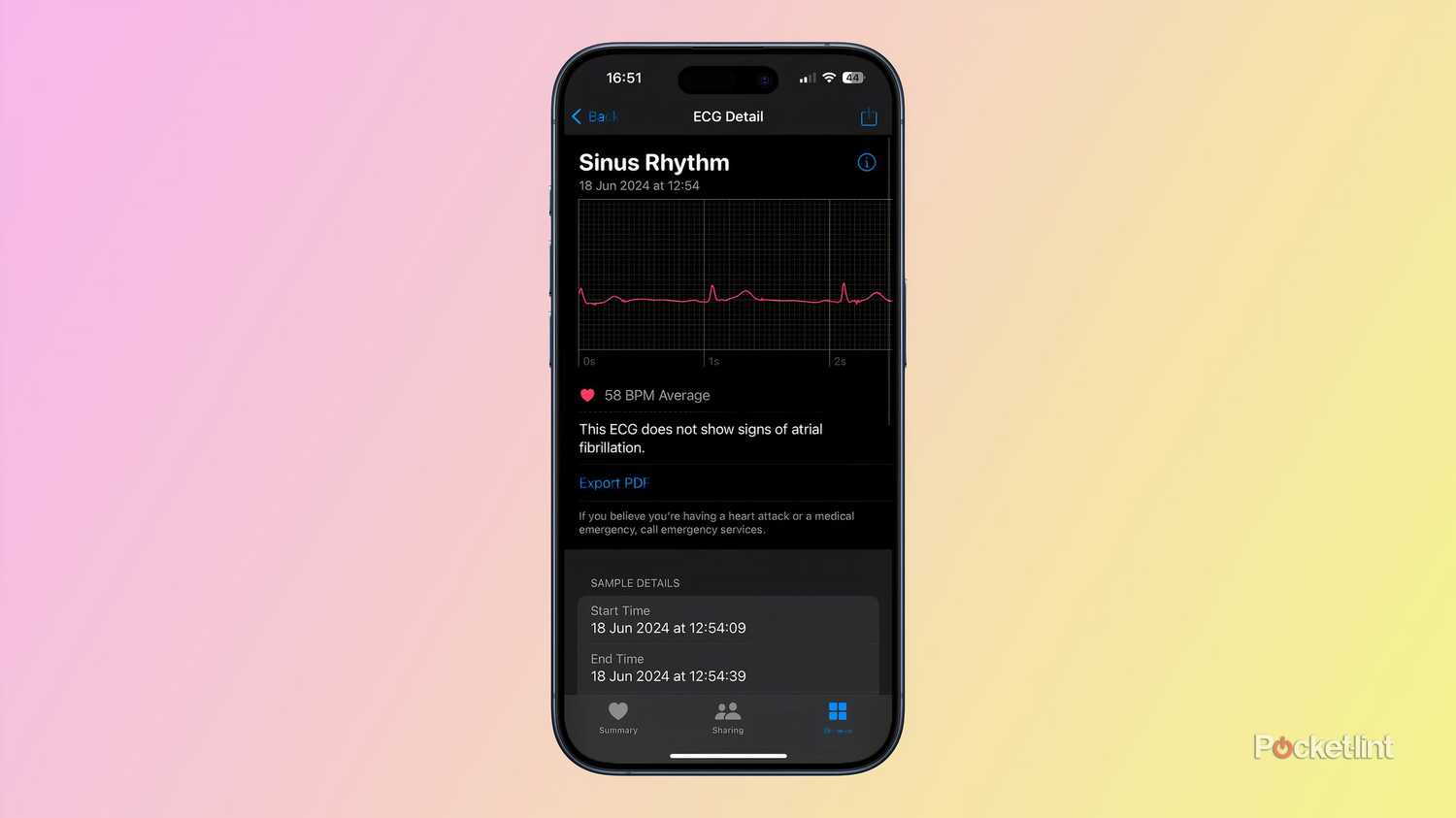Heart Rhythm Notification App For Ecg On Apple Watch How To Set Up