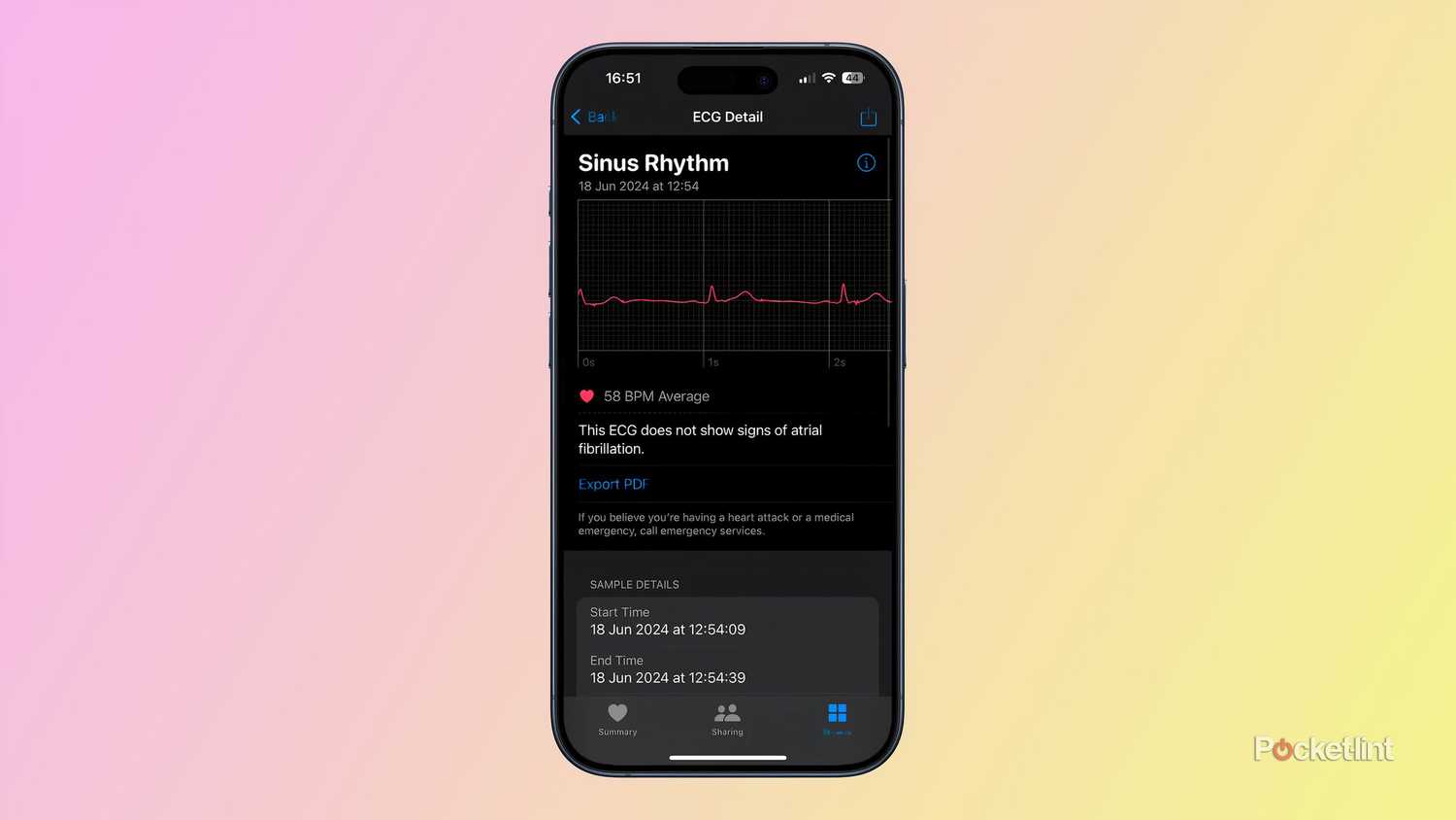 Sinus Rhythm How To Take An Electrocardiogram Apple Watch How To