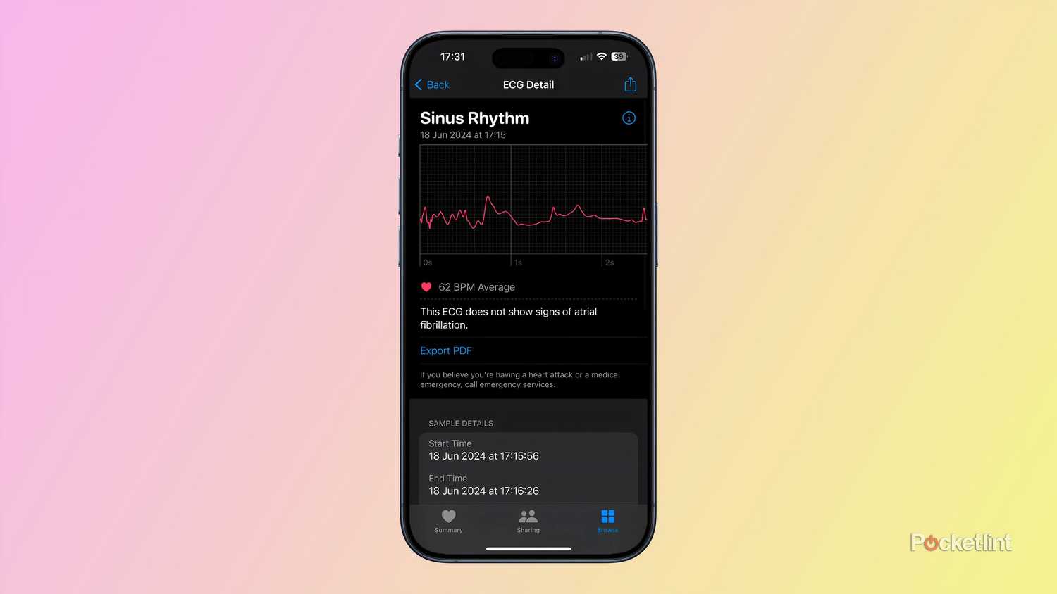 How to set up your Apple Watch's ECG heart health features